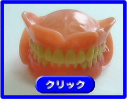 補綴物の紹介